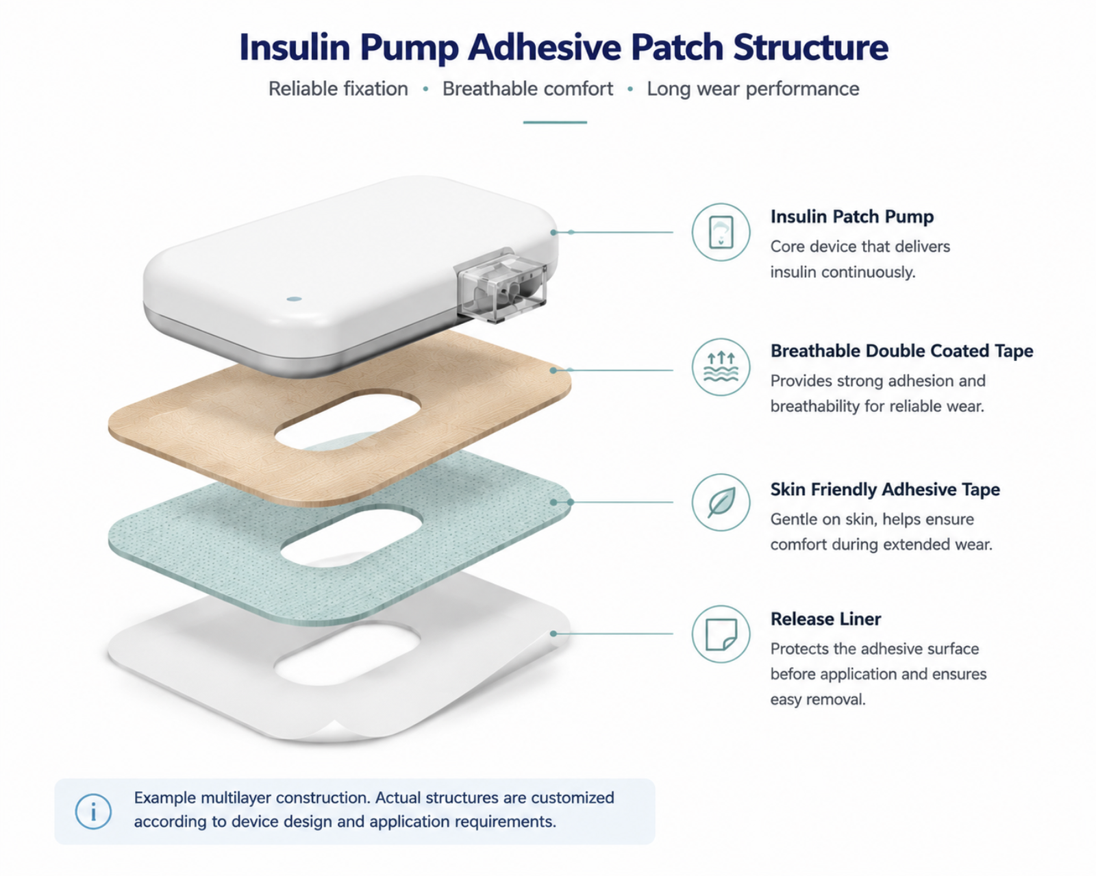 Exploded structure of an insulin pump adhesive patch with device, breathable tape, skin-friendly adhesive, and release liner